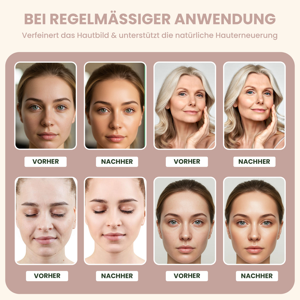 Enzympeeling