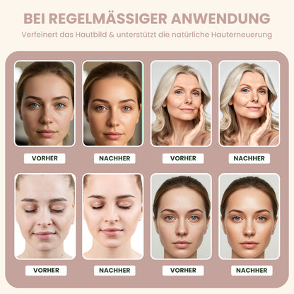 Enzympeeling